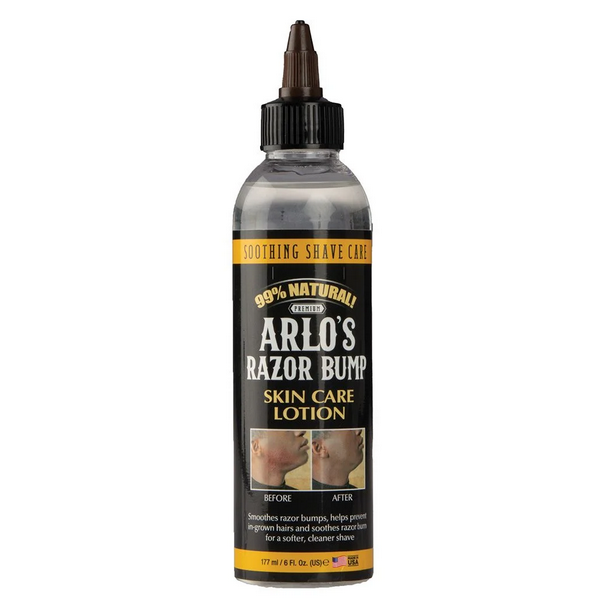 Arlo's Razor Bump Skin Lotion 177ml